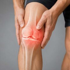 Οστεοαρθρίτιδα Γόνατος (Knee Osteoarthritis)