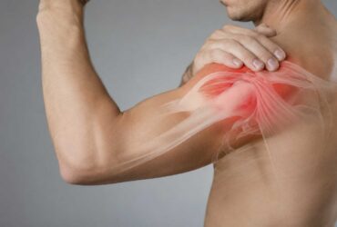Σύνδρομο-υπακρωμιακής-προστριβής Man holding his shoulder with highlighted pain in the rotator cuff area